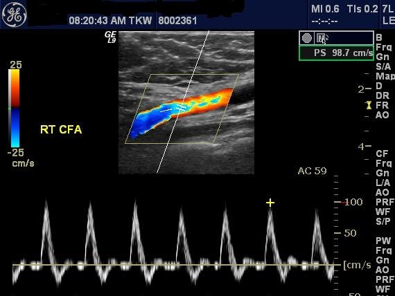 cardiovascular-institute-of-michigan-arterial-doppler